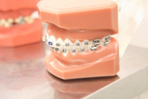 orthodontic_img001