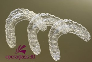 orthodontic_img004